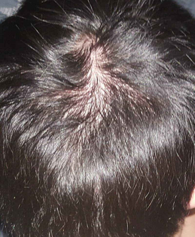 20170428_050740.jpg