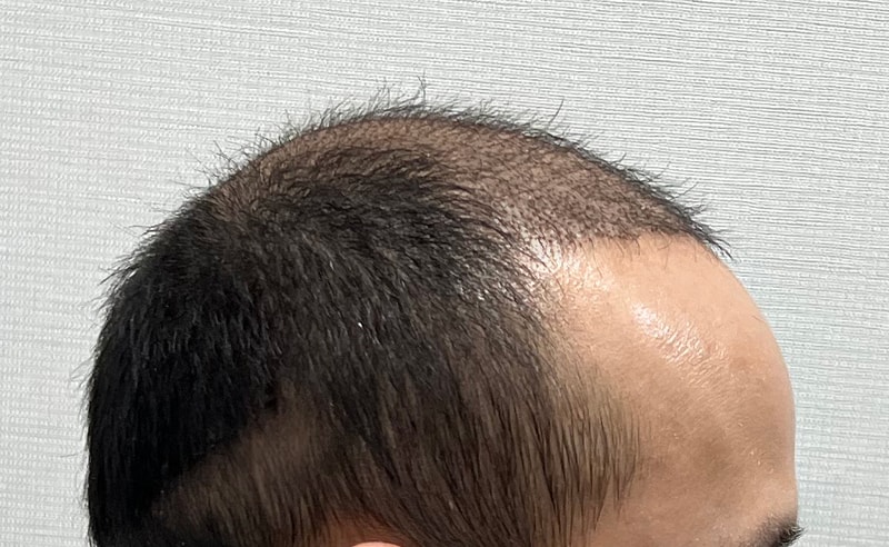 KakaoTalk_20230323_113810661.jpg