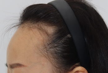 사본 -IMG_7326.jpg