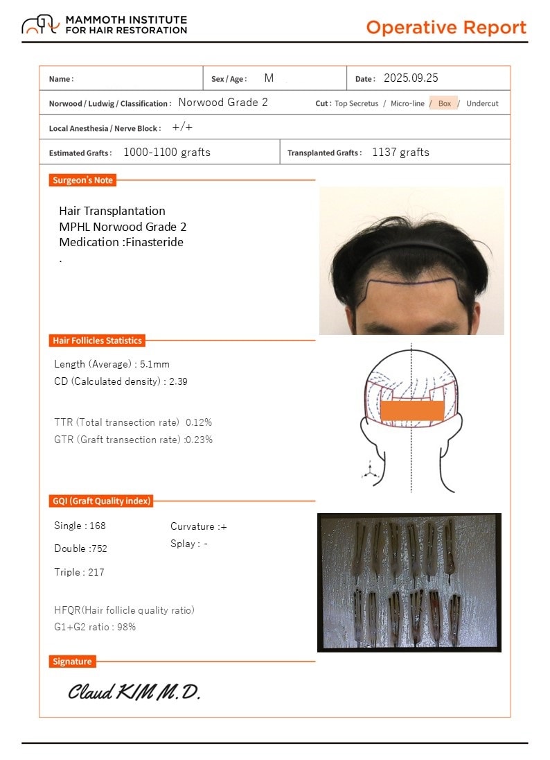 포토후기 이미지