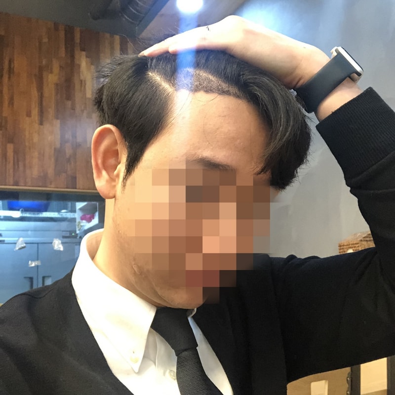 02.이대영_수술15일.jpg