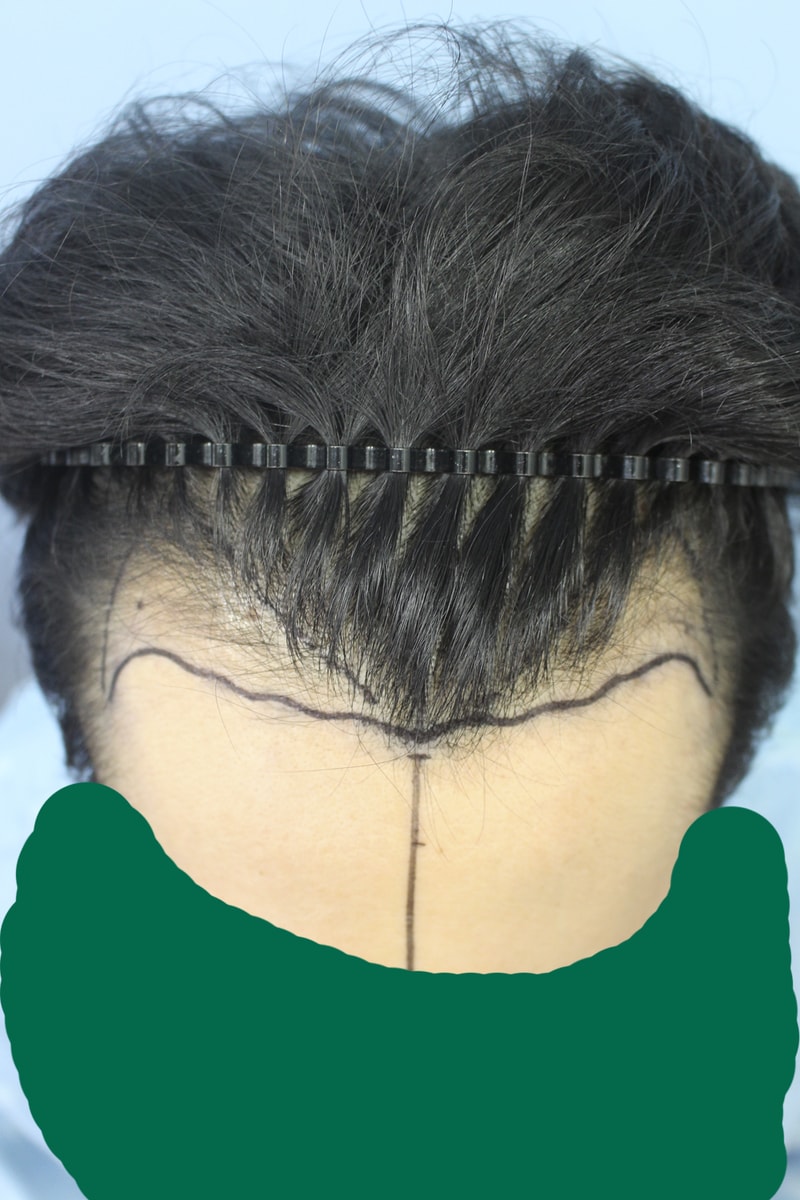 003.jpg