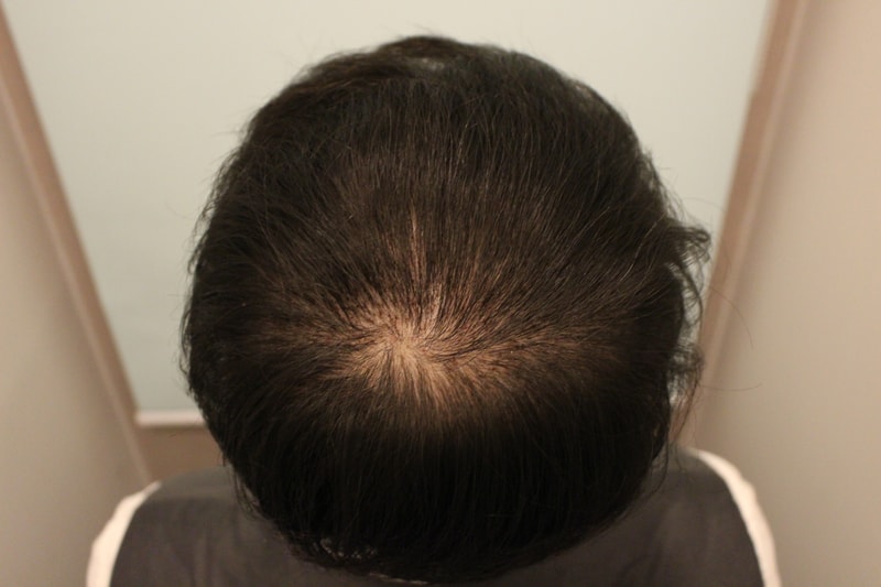 수술후 10일 3.JPG