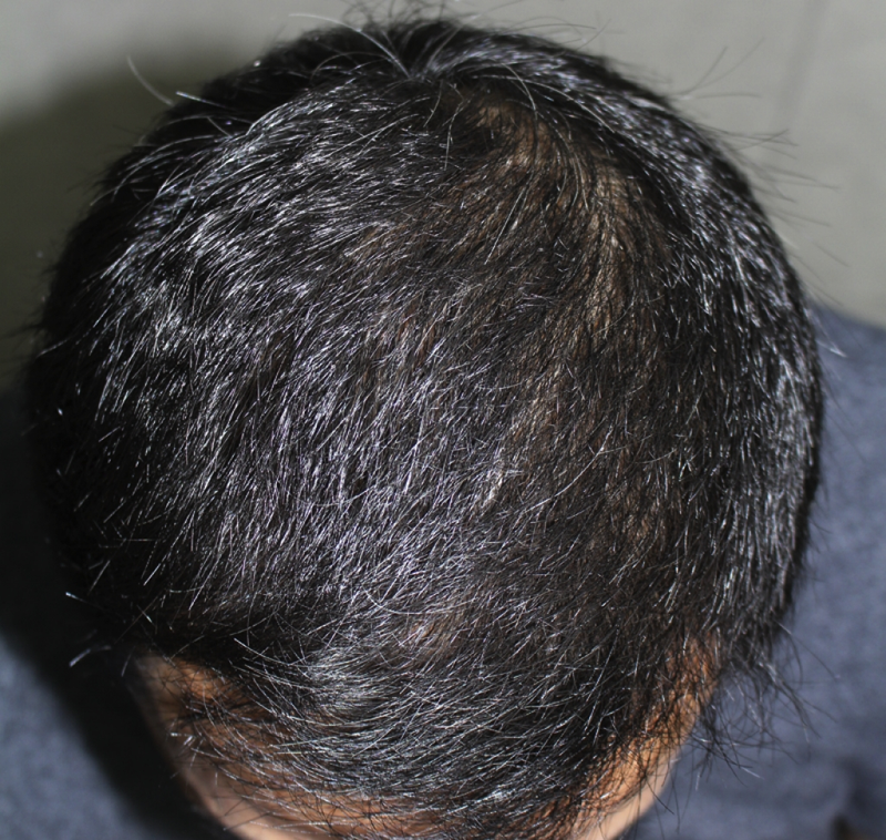 IMG_8133_1년.png