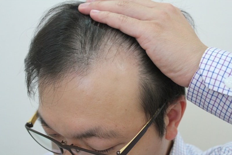どうかうまくいくように願う気持ちで上げる···ビジョルゲ3000毛のレビューです。