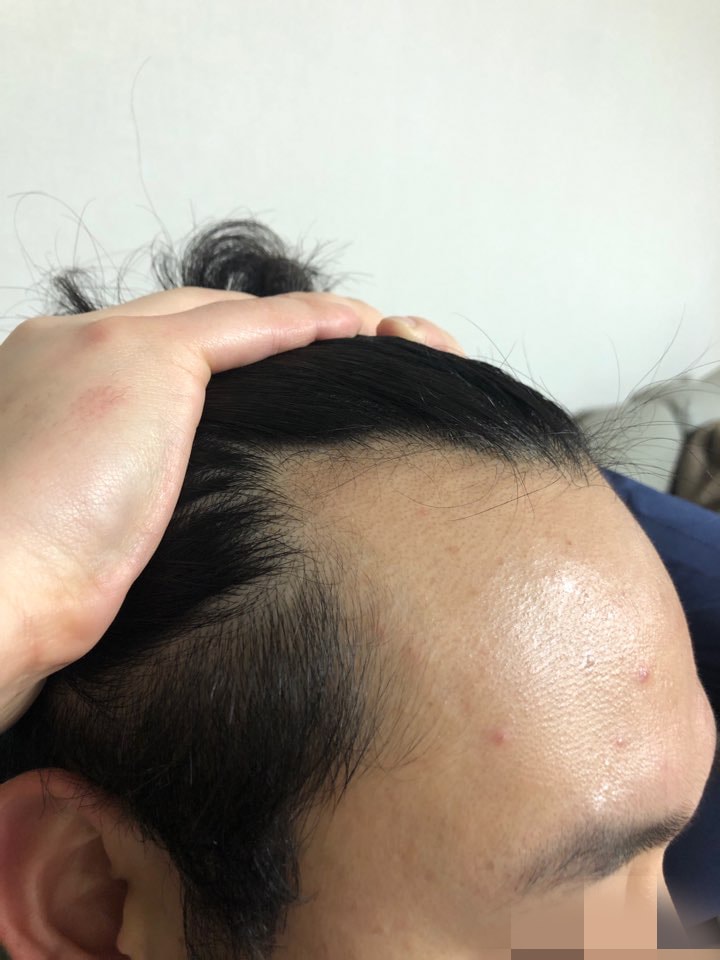 Mo Plus m-shaped cut 2500 Mo review