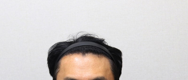 4. 6개월 정면 IMG_9248.JPG