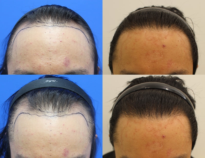 포토후기 이미지