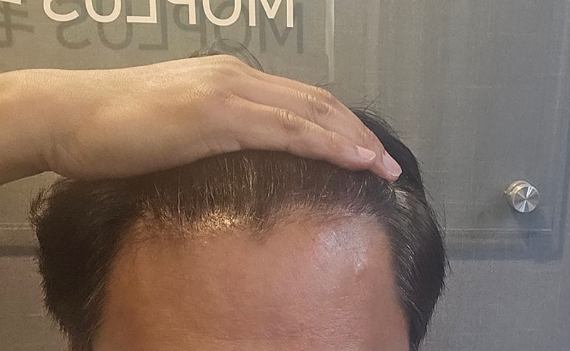 5.1년1개월 정면 자세가 그래서 사진이 삐뚤게 나왔습니다.jpg