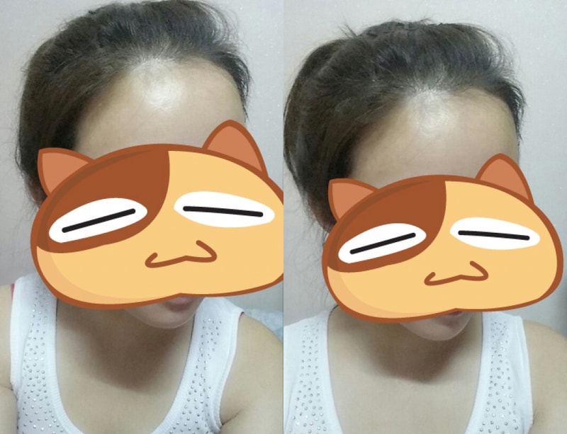 수술후.jpg