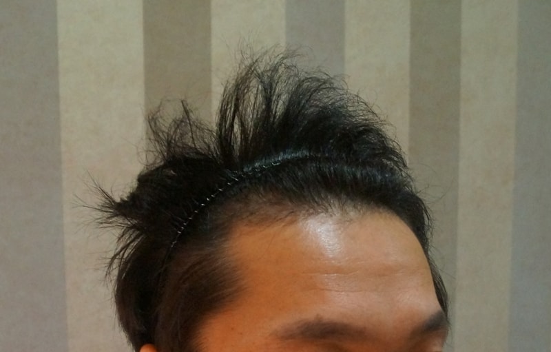 수술전1.jpg