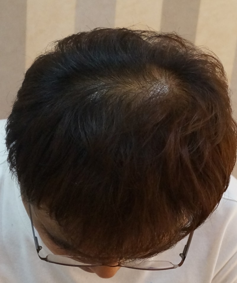 후2.jpg