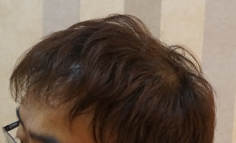 후4.jpg