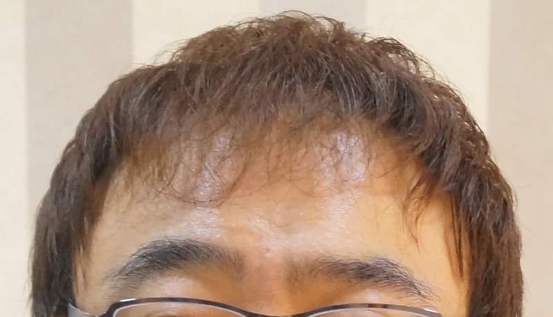 후3.jpg