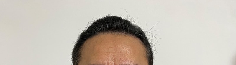 1年目のロングヘア無剃髪
