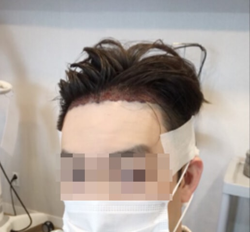 Mo+m字 非接缝 2420 毛