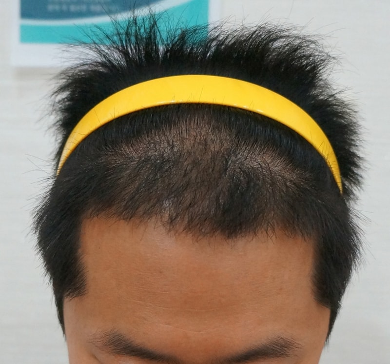 정수리1.jpg