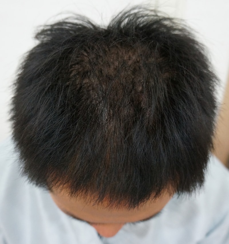 정수리3.jpg