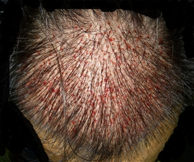 %B4%EB%B4%D9%B8%F0%BB%E7%BF%EB_talmo112.jpg