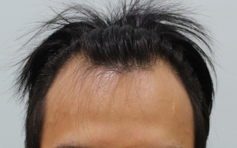 01.jpg
