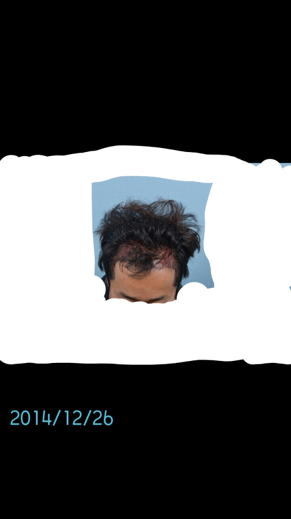 2014-12-26-17-28-34.png