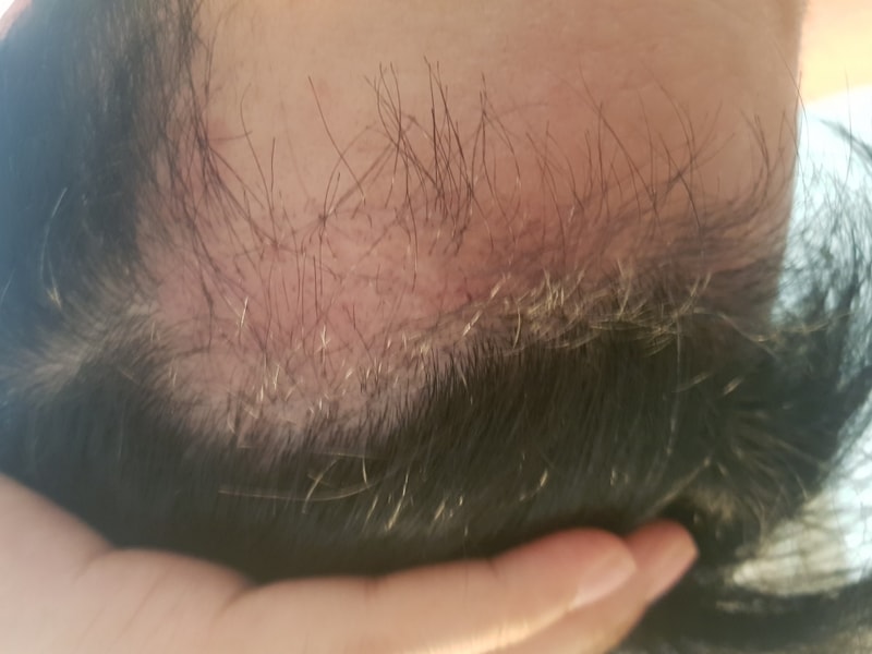2개월 3개월 4개월차 사진입니다.