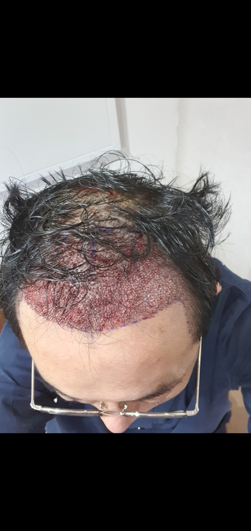 手術当日の写真です。