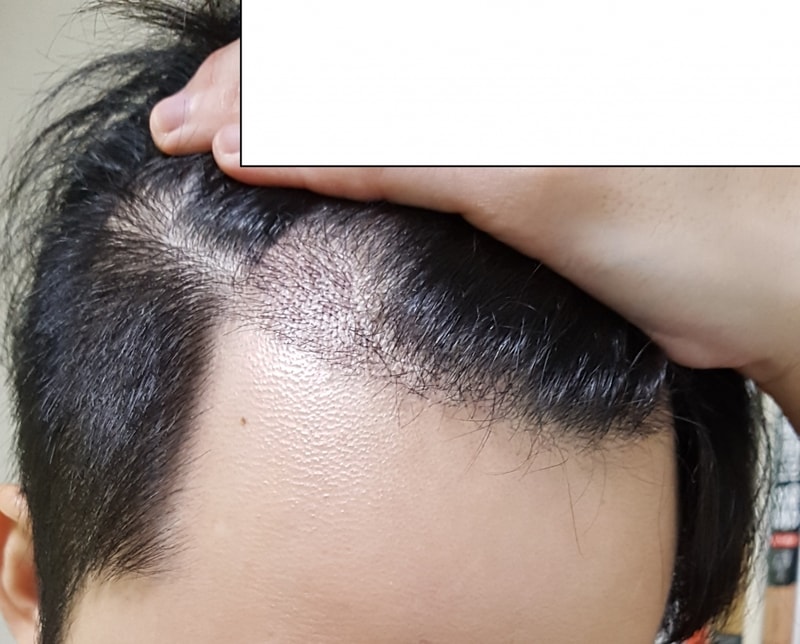 KakaoTalk_20180822_140744454.jpg
