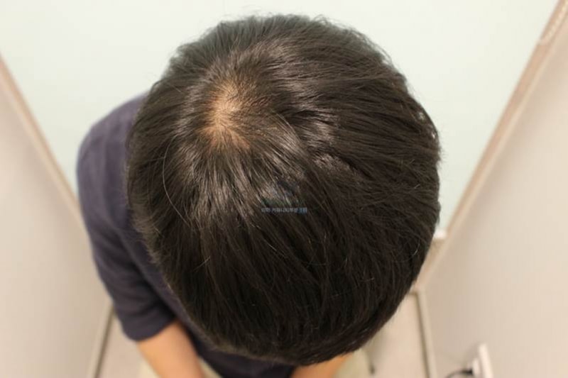 3달.jpg