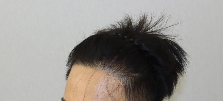 전 2.JPG