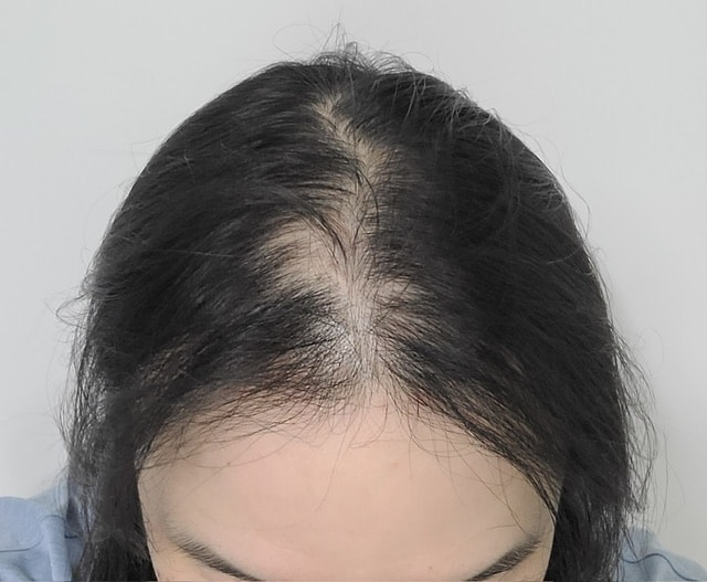 釜山ポヘアのパク·サンゴン院長、暗黒期後半少しずつ育っていますね