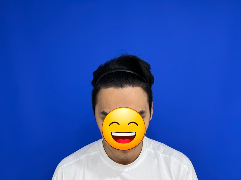 모발이식9개월.jpg