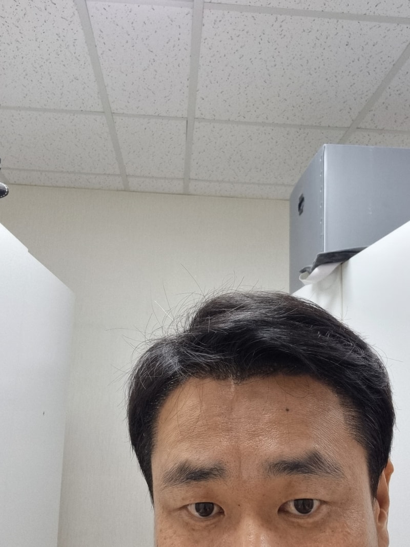 10일후.jpg
