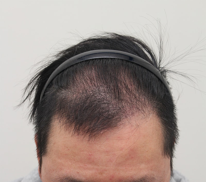 6.5개월째.jpg