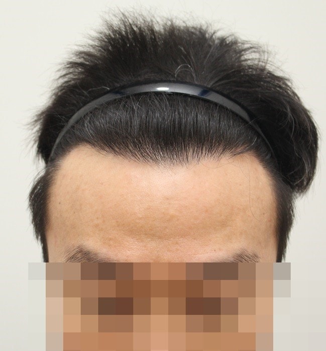 콩콩이다 2.jpg