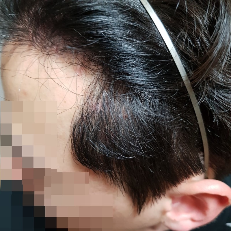 모자이크_좌.jpg