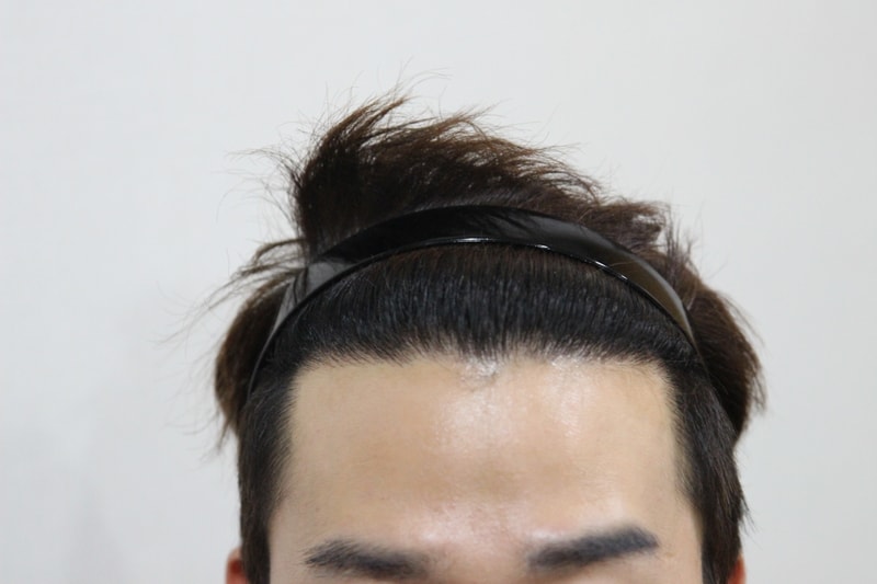 후2.JPG