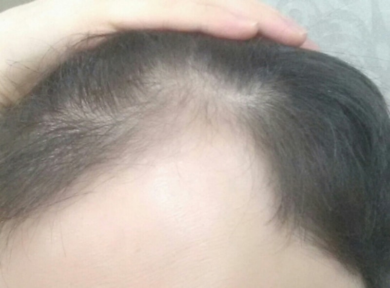수술전2.jpg