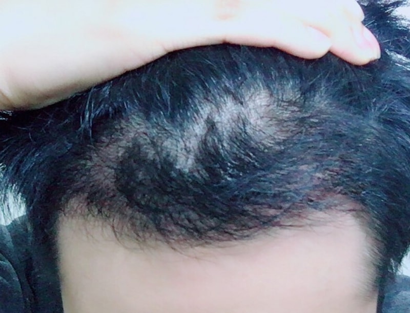 KakaoTalk_20180313_170926328.jpg