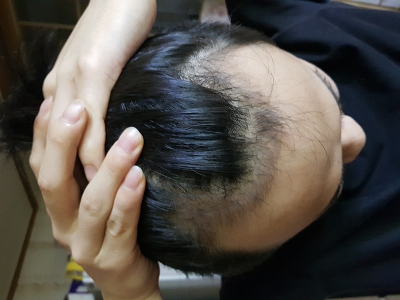 수술전날.jpg