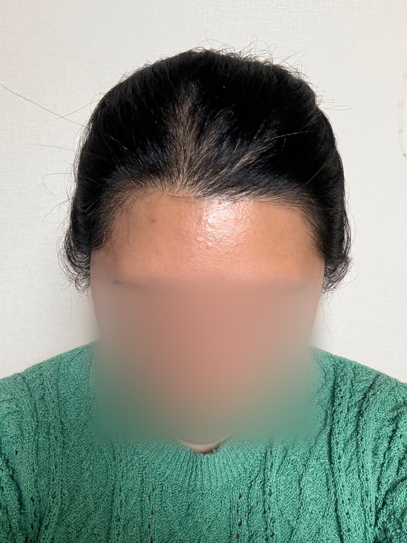 박새봄3개월 모자이크3.jpg