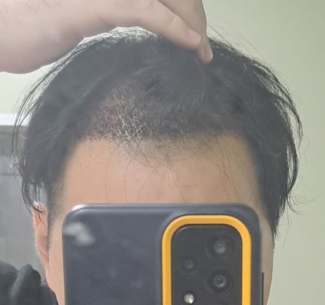 후1.jpg