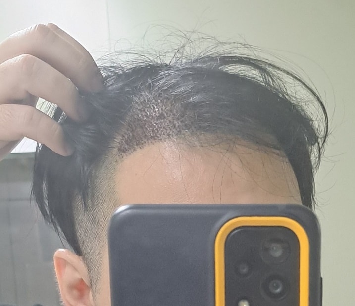 후2.jpg