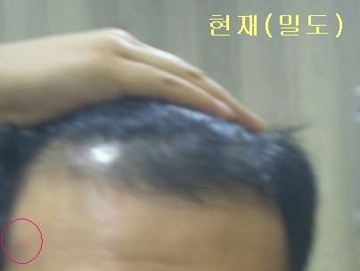 현재밀도.jpg