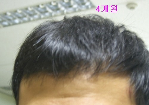 4개월.jpg