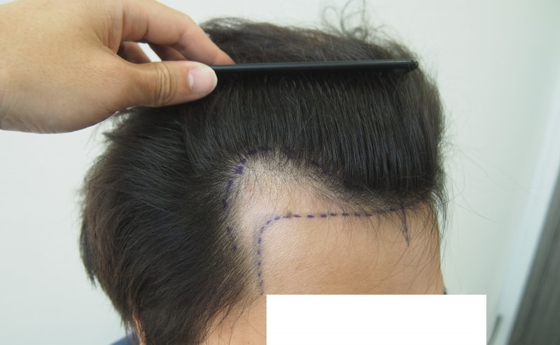 Before-측면2.JPG