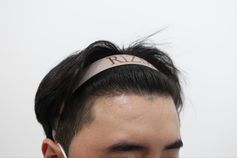 수술 240일차 좌.jpg