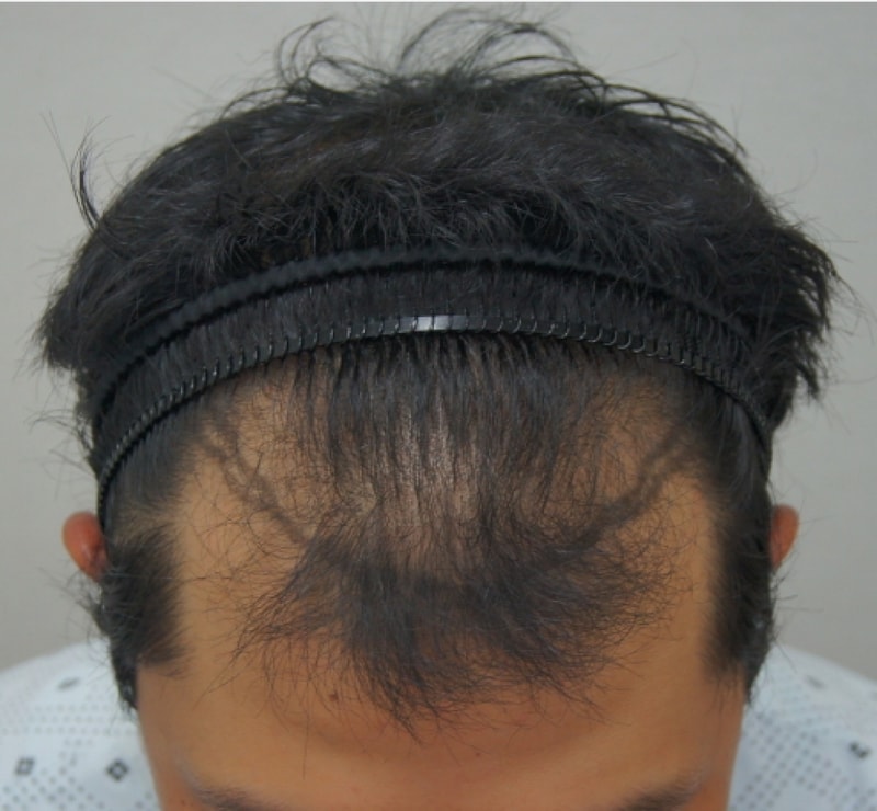 수술전-1.jpg