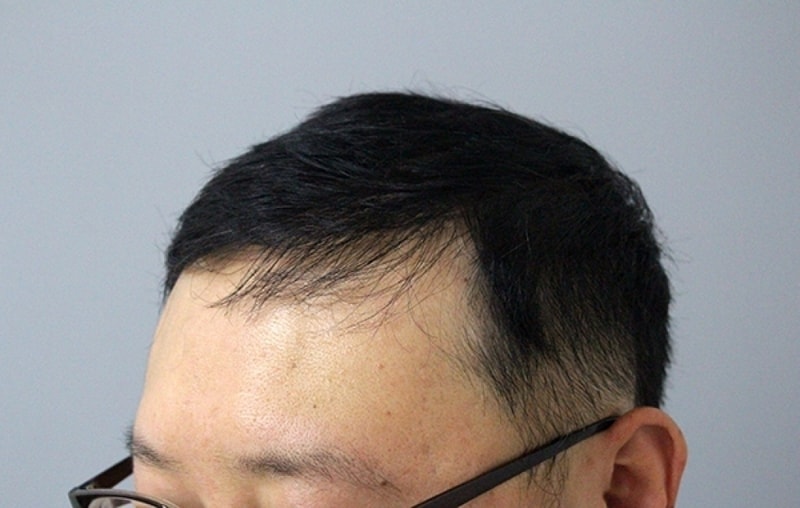 수술후3.jpg