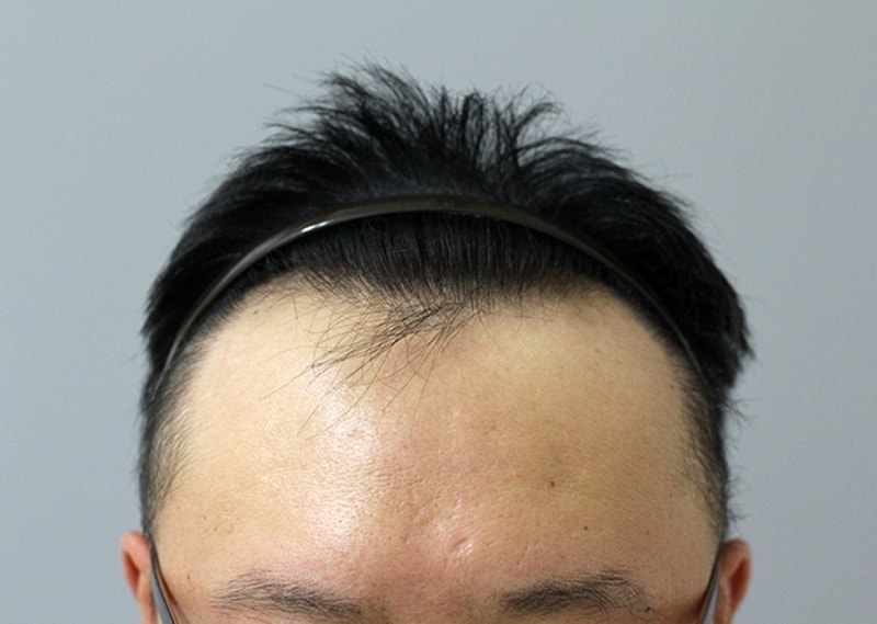 수술전1.jpg